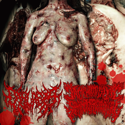 Jackhammer Sphincter Removal : Gore Swamped in Vaginal Cesspool